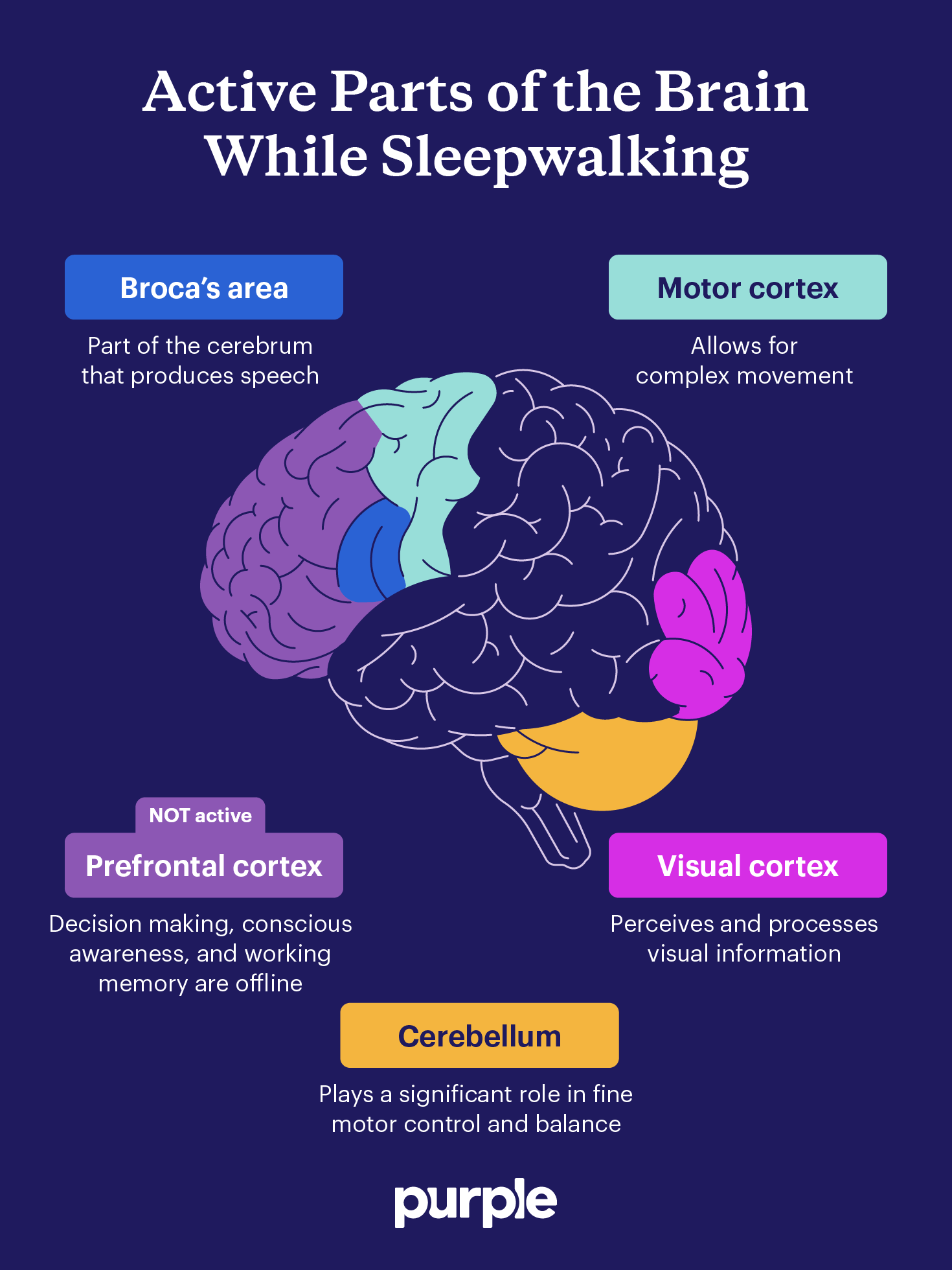 A depiction of the parts of the brain that may be active while sleepwalking.